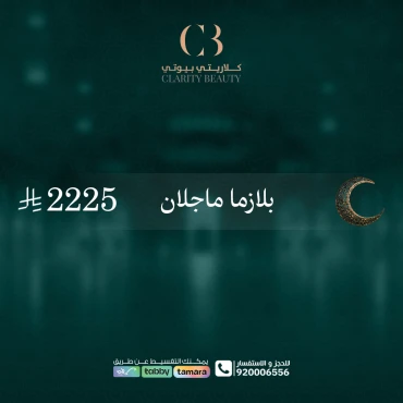 بلازما ماجلان