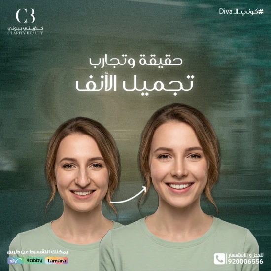 حقيقة وتجارب تجميل الأنف: هل النتيجة تستحق؟