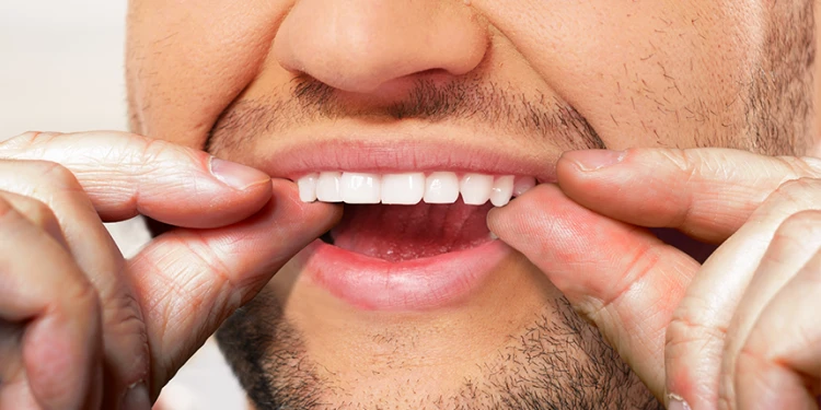 ابتسامة هوليود المتحركة